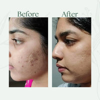 Alfis Beauty | Instant Glowing Cream | 35 G