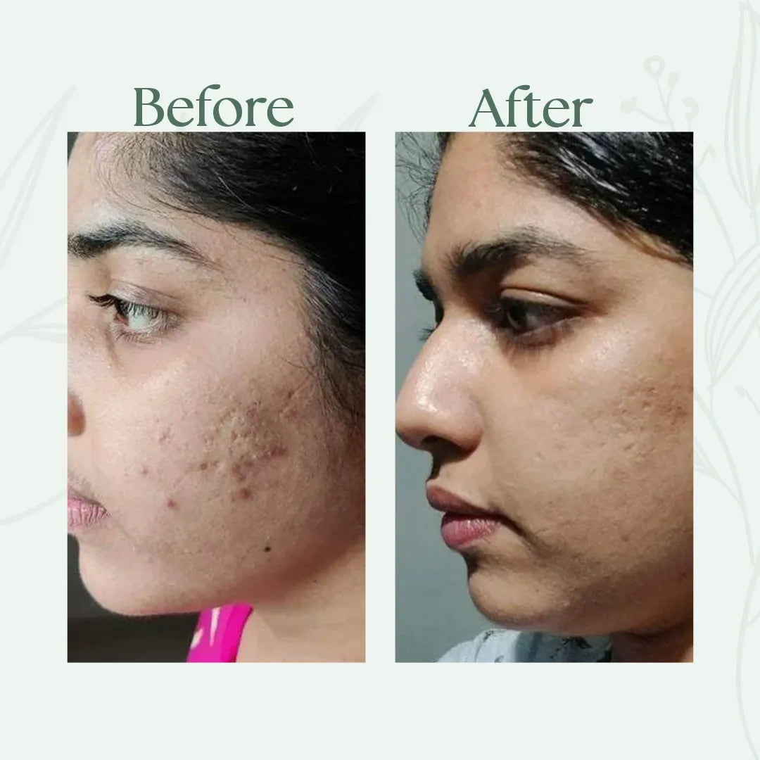 Alfis Beauty | Instant Glowing Cream | 35 G