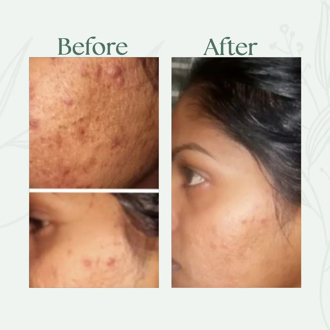 Alfis Beauty | Instant Glowing Cream | 35 G