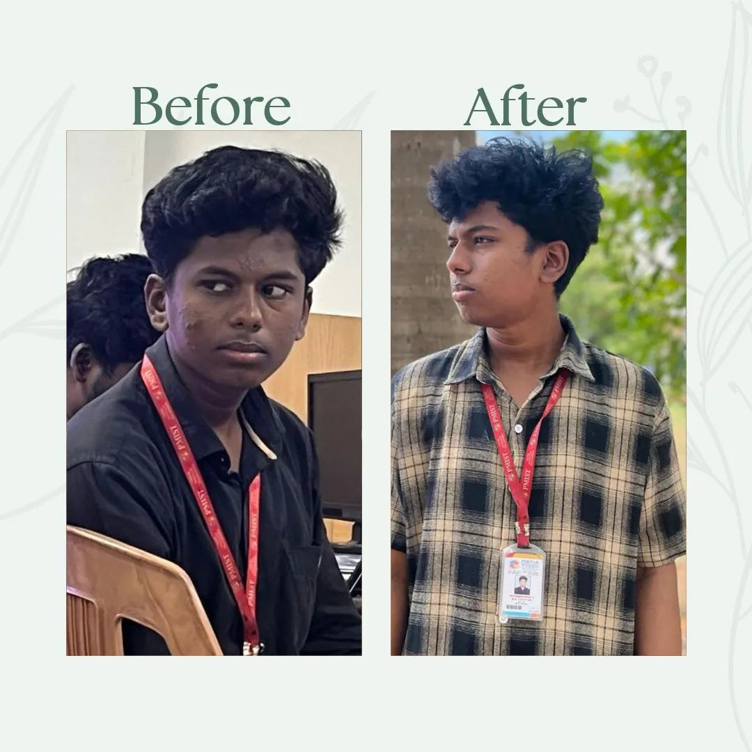 Alfis Beauty | Instant Glowing Cream | 35 G