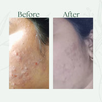 Alfis Beauty | Instant Glowing Cream | 35 G