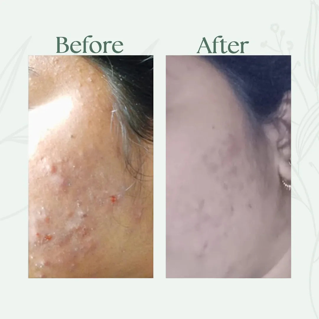 Alfis Beauty | Instant Glowing Cream | 35 G